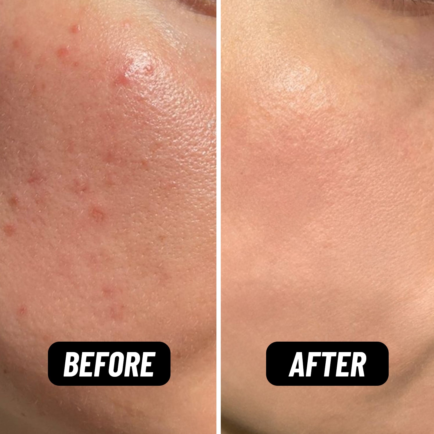 Before and after comparison of skin using HotChi facial oils — left side shows dehydrated, dull skin, right side shows hydrated, glowing skin with strengthened skin barrier.