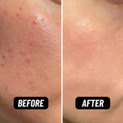 Before and after comparison of skin using HotChi facial oils — left side shows dehydrated, dull skin, right side shows hydrated, glowing skin with strengthened skin barrier.