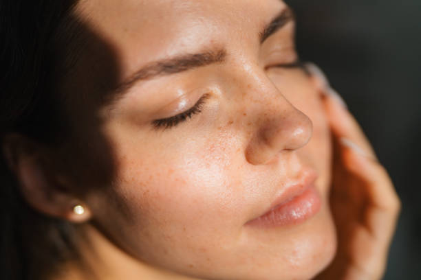 Skin Concern: Damaged Skin Barrier