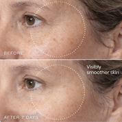 Brightr® Eye wrinkle smoothing patches