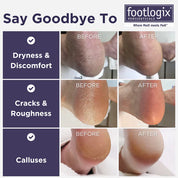 Footlogix Ultimate "W Domu" Zestaw Pielęgnacji Stóp (100ml)