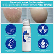 Footlogix Formuła na Pękające Pięty (125ml)
