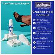 Footlogix Formuła na Pękające Pięty (125ml)