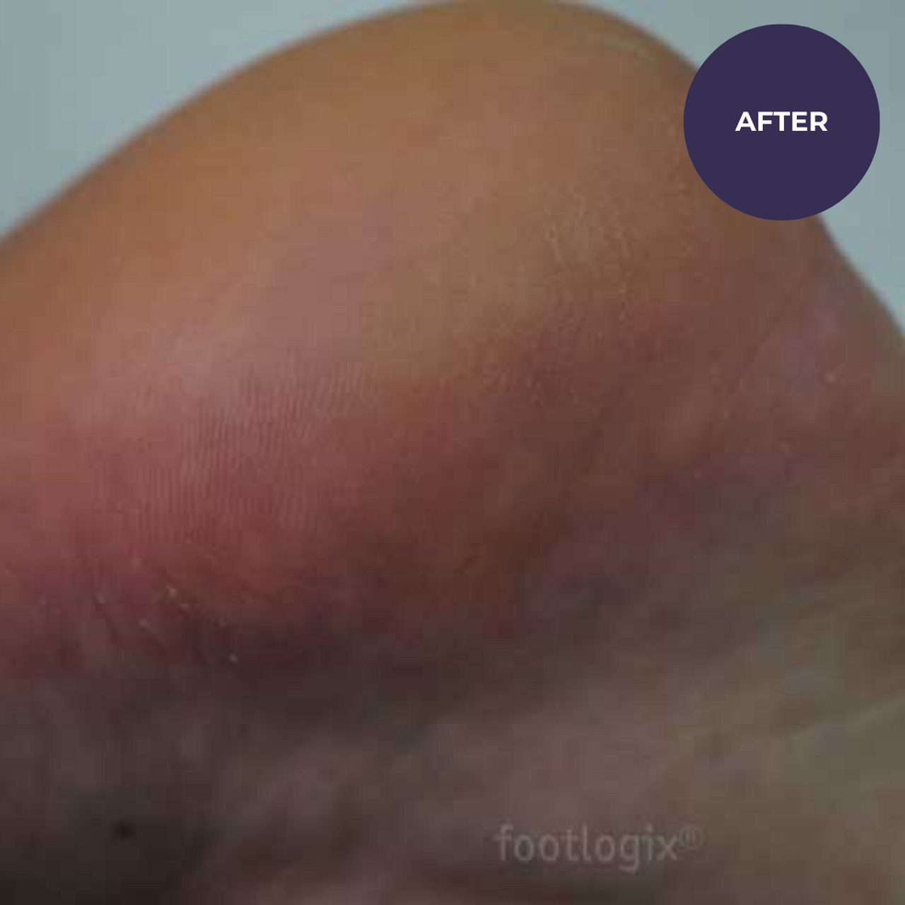 Footlogix Formuła DD Cream Mousse (125ml)