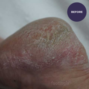 Footlogix Formuła DD Cream Mousse (125ml)