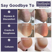 Footlogix Dwustronna Pilnik do Stóp z Gumową Rączką - Grubo/Drobno