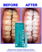 Multi-Mode Sonic Electric Toothbrush