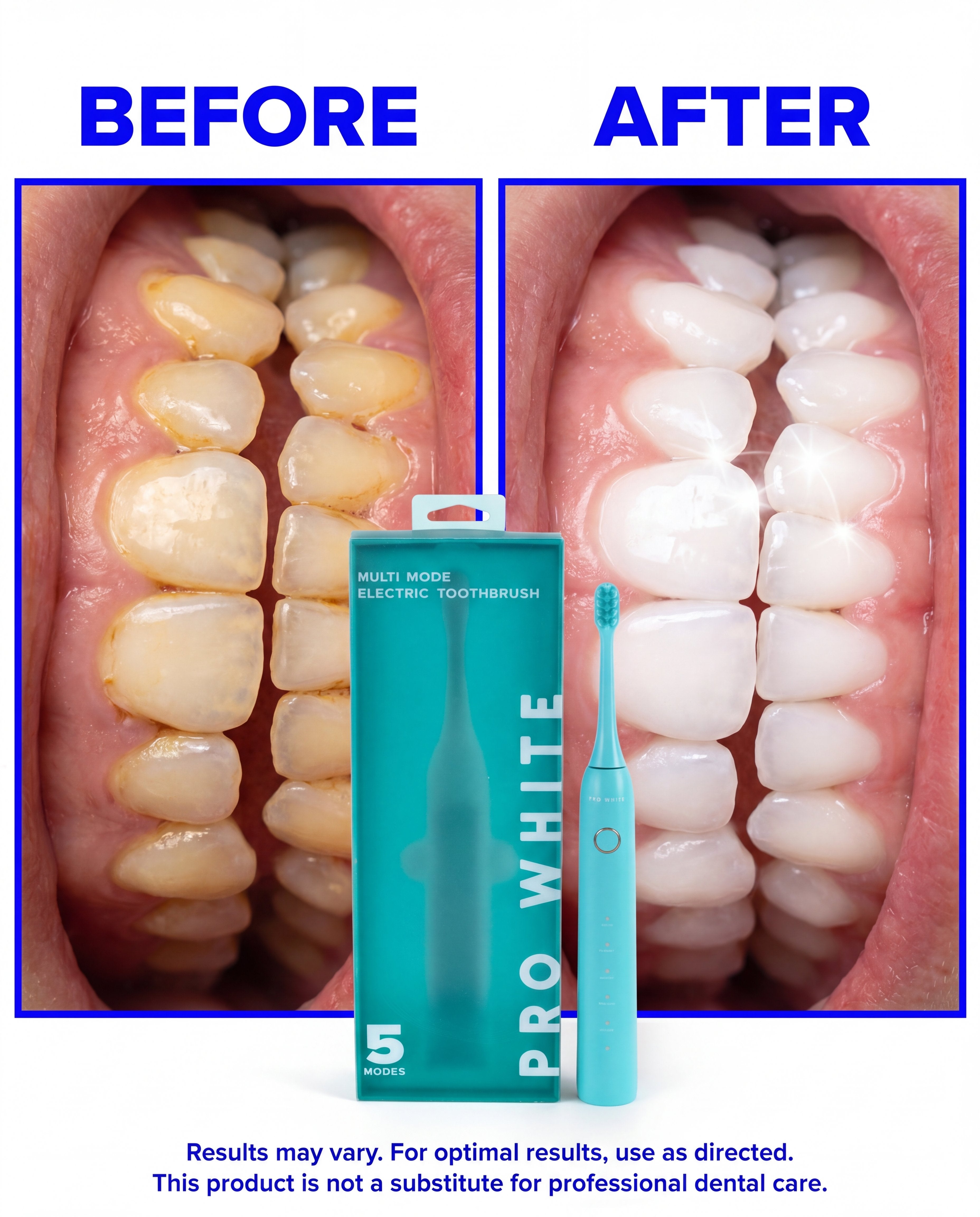 Multi-Mode Sonic Electric Toothbrush