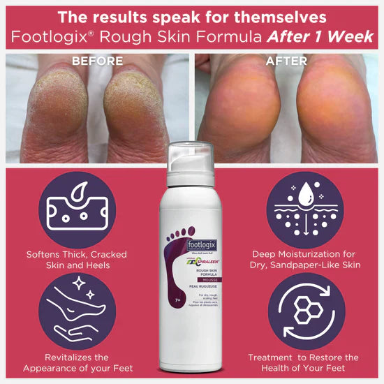 Footlogix Crème Peaux Rugueuses (125 ml)