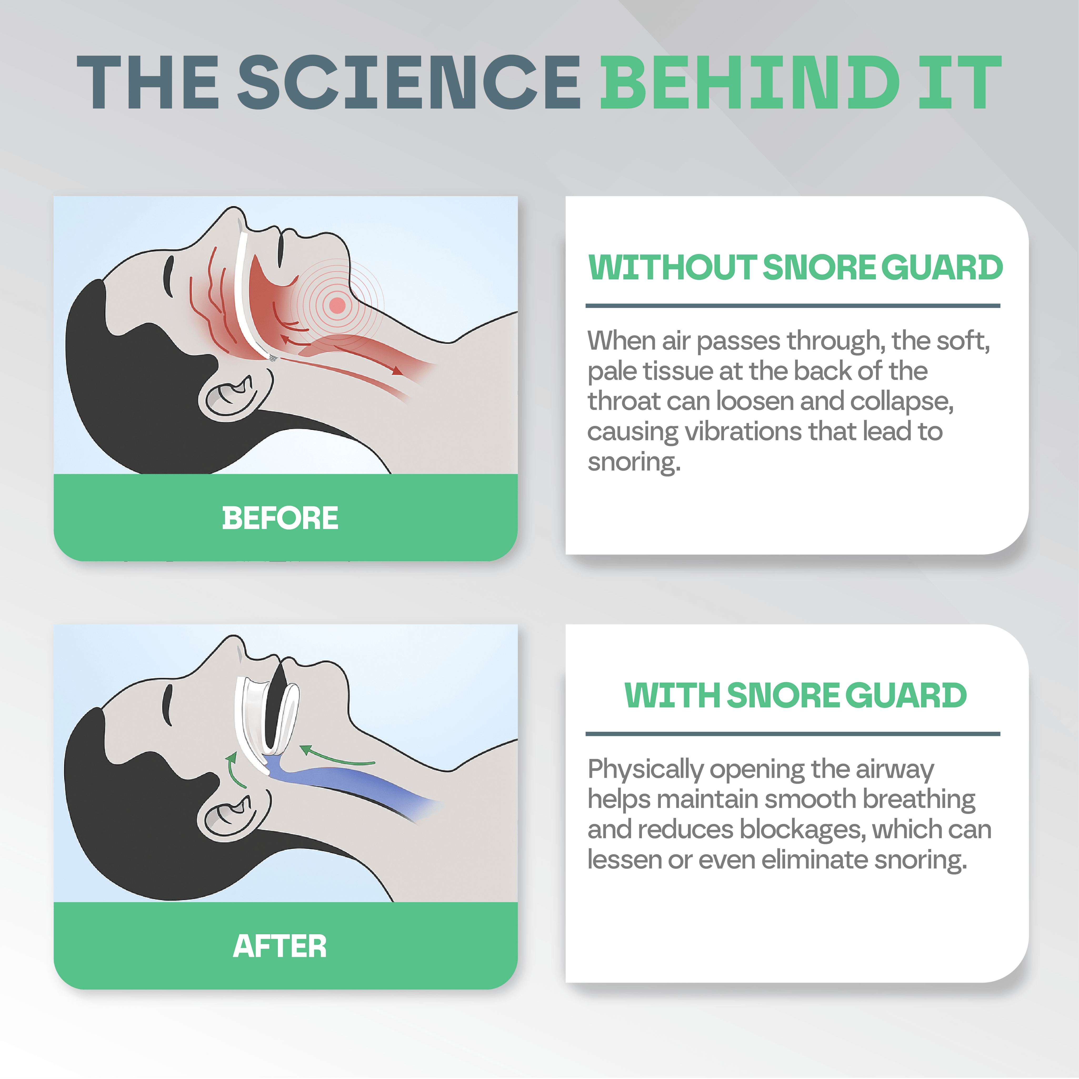 Anti Snore Mouth Guard Pro