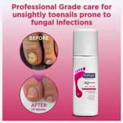 Footlogix Toe Nail Tincture (50ml)