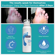 Footlogix Formuła na Bardzo Suchą Skórę (125ml)