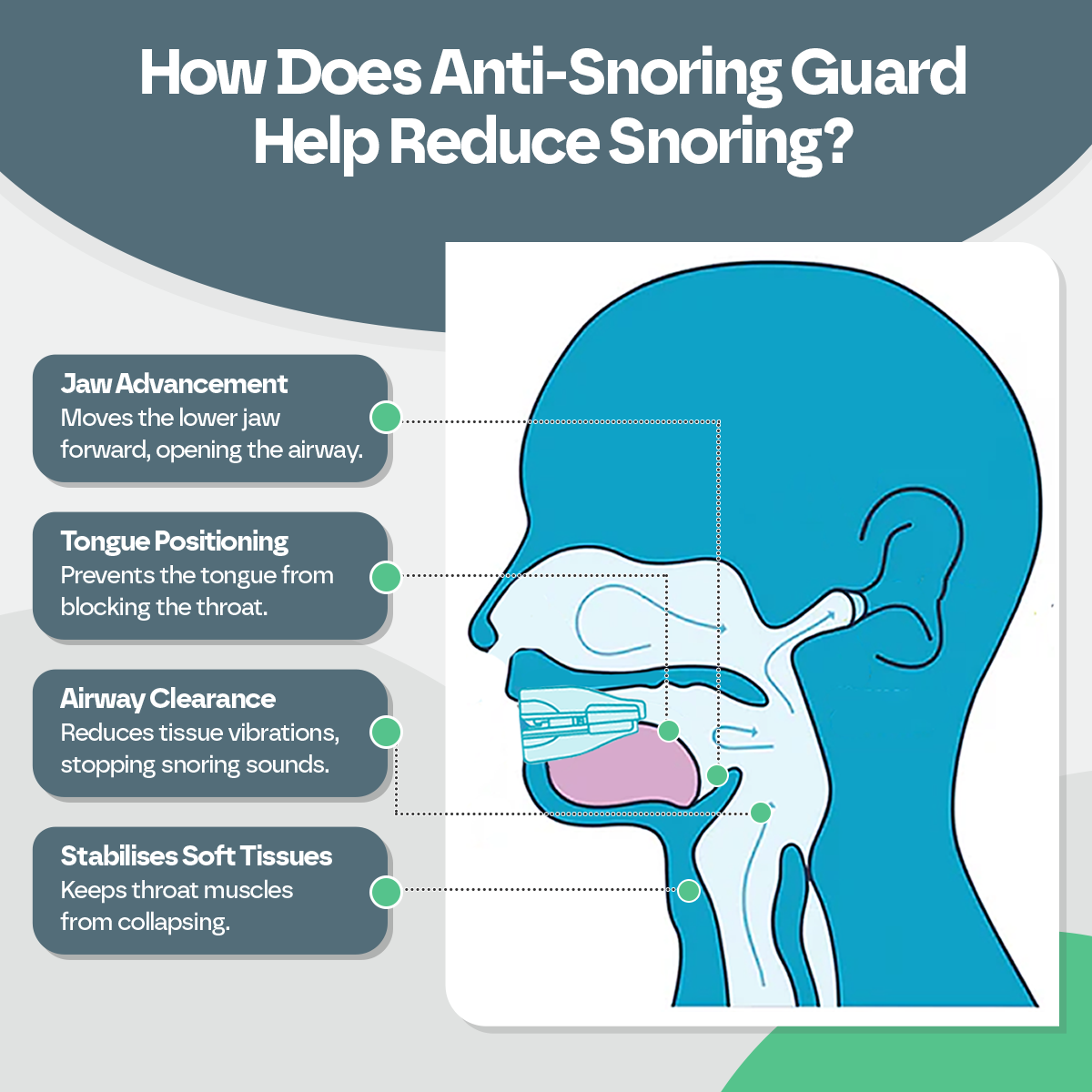 Diagram explaining how an anti-snoring guard works with text labels.
