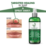 Thyme Out All Natural Eczema Treatment & Anti-Itch Spray | Acne, Psoriasis & More (4oz)